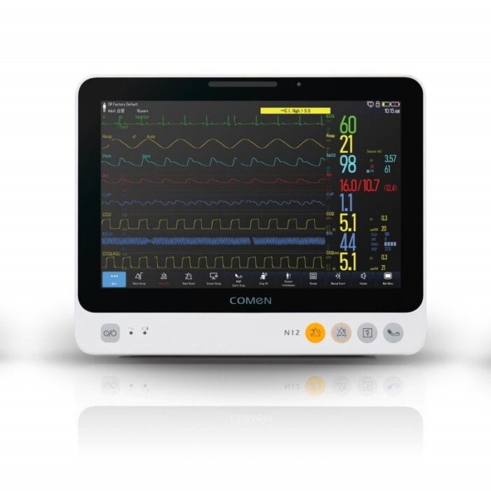 MONITEUR PATIENT N10 - ECG 3/5/12 Dérivations-COMEN